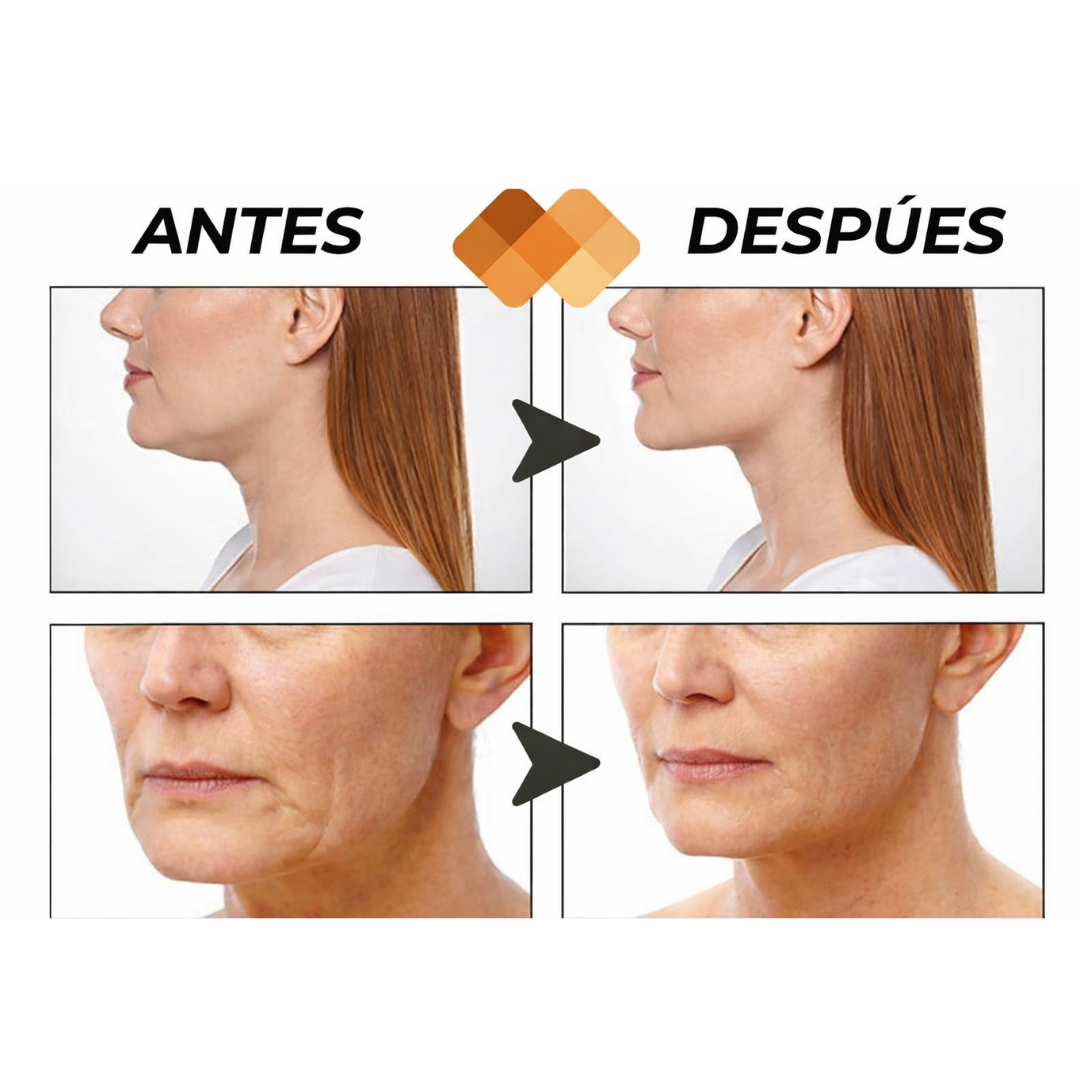 Reafirmación facial visible, alternativa estética no invasiva