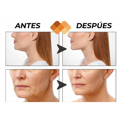 Reafirmación facial visible, alternativa estética no invasiva